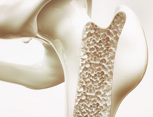 Osteoporosi e la magnetoterapia